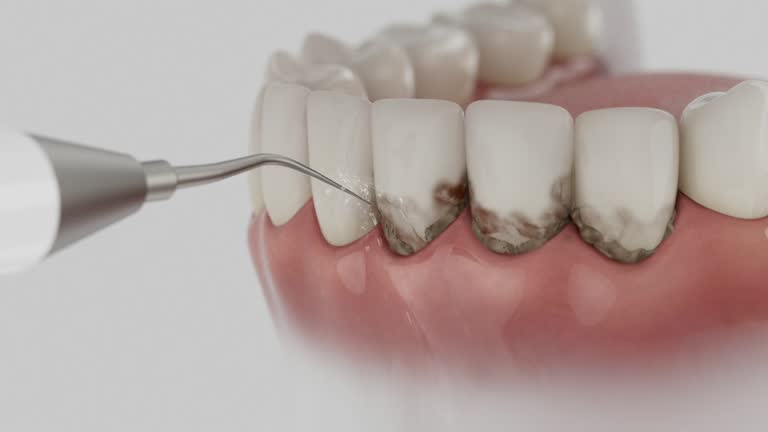 Trusted Tooth Extraction service in Lafayette, CA - Dentist Open Now